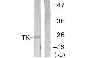 Western blot analysis of extracts from COLO205 cells, using TK (epitope around residue 13) antibody. (TK (N-Term), (Ser13) anticorps)