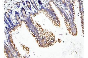 IHC analysis of LOR using anti-LOR antibody (ABIN6719582). (LOR anticorps  (AA 1-312))