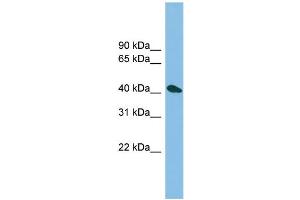 WB Suggested Anti-ZNF514 Antibody Titration: 0. (ZNF514 anticorps  (N-Term))