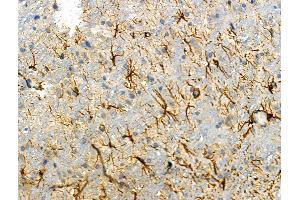 ABIN6261940 and ABIN6276315 at 1/100 staining Rat brain tissue by IHC-P.