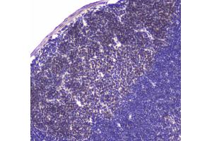 IHC analysis of HAUSP/USP7 using anti-HAUSP/USP7 antibody .