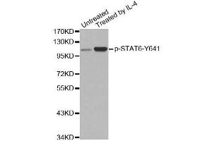 Western blot analysis of extracts from Hela cells,using Phospho-STAT6-Y641 antibody. (STAT6 anticorps  (pTyr641))