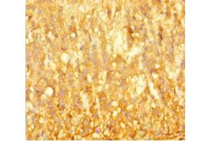 Immunohistochemistry of paraffin-embedded human adrenal gland tissue using ABIN7145808 at dilution of 1:100 (BRD3 anticorps  (AA 356-506))