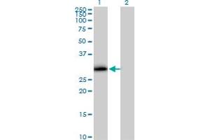 Western Blot analysis of VAPA expression in transfected 293T cell line by VAPA MaxPab polyclonal antibody. (VAPA anticorps  (AA 1-242))