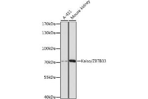Western blot analysis of extracts of various cell lines, using Kaiso/Kaiso/ZBTB33 antibody  at 1:3000 dilution. (ZBTB33 anticorps  (AA 523-672))