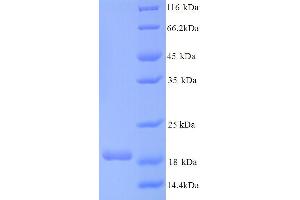 SDS-PAGE (SDS) image for Connector Enhancer of Kinase Suppressor of Ras 2 (CNKSR2) (AA 650-800) protein (His tag) (ABIN5713368)