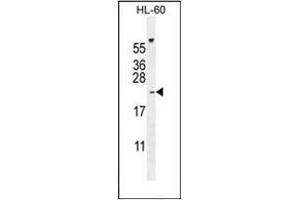 Western blot analysis of PLA2G2C Antibody (C-term) in HL-60 cell line lysates (35ug/lane).