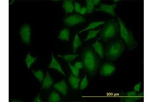 Immunofluorescence of monoclonal antibody to CDK4 on HeLa cell. (CDK4 anticorps  (AA 211-303))