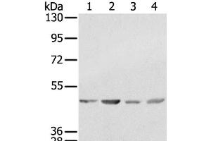 Western Blot analysis of K562, 231, Raji and hela cell using SSB Polyclonal Antibody at dilution of 1:400 (SSB anticorps)