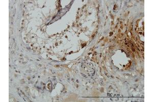 anti-Tripartite Motif Containing 49 (TRIM49) (AA 251-340) antibody