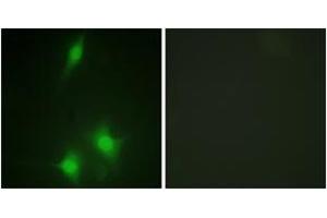 Immunofluorescence analysis of NIH-3T3 cells, using MDM2 (Ab-186/188) Antibody.