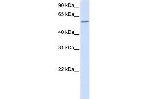 PPP3CA antibody used at 1 ug/ml to detect target protein. (PPP3CA anticorps)