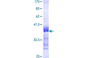 Image no. 1 for Transforming, Acidic Coiled-Coil Containing Protein 3 (TACC3) (AA 1-100) protein (GST tag) (ABIN1322044)