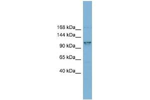 WB Suggested Anti-CCDC87 Antibody Titration: 0. (CCDC87 anticorps  (N-Term))