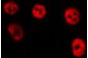 ABIN6275339 staining HepG2 by IF/ICC.