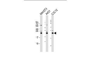 All lanes : Anti-RAB7 Antibody (C-term) at 1:2000 dilution Lane 1: NIH/3T3 whole cell lysate Lane 2: A431 whole cell lysate Lane 3: C2C12 whole cell lysate Lysates/proteins at 20 μg per lane. (RAB7A anticorps  (C-Term))