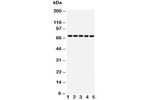 Western blot testing of HSP70 antibody and Lane 1:  293T