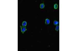 Immunofluorescent analysis of MCF-7 cells using ABIN7147459 at dilution of 1:100 and Alexa Fluor 488-congugated AffiniPure Goat Anti-Rabbit IgG(H+L) (CERKL anticorps  (AA 1-558))