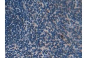 Detection of Grb7 in Mouse Spleen Tissue using Polyclonal Antibody to Growth Factor Receptor Bound Protein 7 (Grb7)