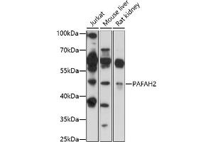 Western blot analysis of extracts of various cell lines, using P antibody (ABIN7269402) at 1:1000 dilution. (PAFAH2 anticorps  (AA 260-350))