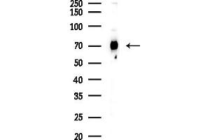 anti-Heat Shock 70kDa Protein 9 (Mortalin) (HSPA9) (C-Term) antibody