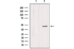 Western blot analysis of extracts from Hela, using L2HGDH Antibody. (L2HGDH anticorps  (Internal Region))