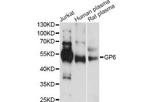 Western blot analysis of extracts of various cell lines, using GP6 antibody (ABIN6293681) at 1:1000 dilution. (GP6 anticorps)