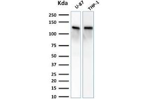 Western Blot Analysis of U-87 and THP-1 cell lysate using VCL Mouse Monoclonal Antibody (VCL/2572). (Vinculin anticorps  (AA 174-322))