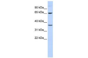 Epsin 2 antibody used at 1 ug/ml to detect target protein. (Epsin 2 anticorps  (Middle Region))