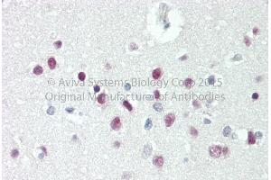 Rabbit Anti-TBX15 antibody   Formalin Fixed Paraffin Embedded Tissue: Human Adult Brain, cortex  Observed Staining: Cytoplasm in hepatocytes Primary Antibody Concentration: 1:600 Secondary Antibody: Donkey anti-Rabbit-Cy3 Secondary Antibody Concentration: 1:200 Magnification: 20X Exposure Time: 0. (T-Box 15 anticorps  (C-Term))