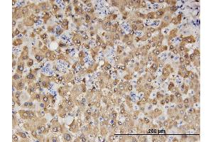 Immunoperoxidase of monoclonal antibody to ALDH1A1 on formalin-fixed paraffin-embedded human liver.