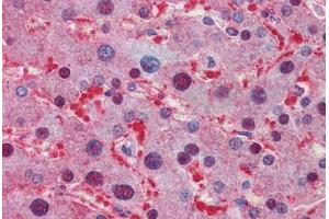 Human Liver: Formalin-Fixed, Paraffin-Embedded (FFPE)