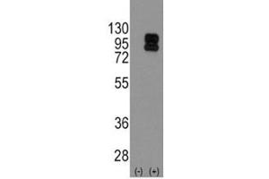 Western blot analysis of CD19 antibody and 293 cell lysate (2 ug/lane) either nontransfected (Lane 1) or transiently transfected with the CD19 gene (2).