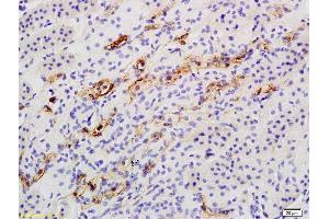 Formalin-fixed and paraffin embedded rat kidney labeled with Anti Catalase Polyclonal Antibody, Unconjugated  followed by conjugation to the secondary antibody and DAB staining