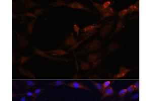 Immunofluorescence analysis of C6 cells using SERPINB9 Polyclonal Antibody at dilution of 1:100.