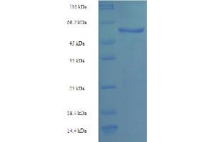 SDS-PAGE (SDS) image for Protein tyrosine Phosphatase, Receptor Type, B (PTPRB) (AA 1643-1997) protein (His-SUMO Tag) (ABIN5710187)