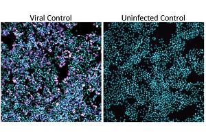 Biosafety Level 3 (BSL-3) SARS-CoV-2 bioassay in H1437 cells with washout step and raw infectivity of H1437 cells by SARS-CoV-2 WA1 strain. (SARS-CoV-2 Nucleocapsid anticorps)