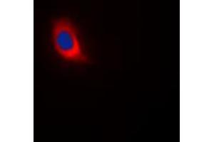 Immunofluorescent analysis of COX4-1 staining in HeLa cells.