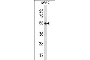 LAX1 Antibody (C-term) (ABIN1537207 and ABIN2850101) western blot analysis in K562 cell line lysates (35 μg/lane). (LAX1 anticorps  (C-Term))