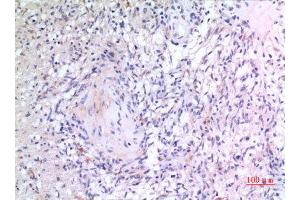 Immunohistochemistry (IHC) analysis of paraffin-embedded Human Brain, antibody was diluted at 1:100.
