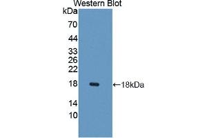 Western blot analysis of the recombinant protein. (CXCL9 anticorps  (AA 22-125))