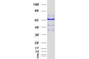 Validation with Western Blot