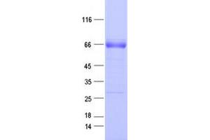 Validation with Western Blot