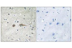 Immunohistochemistry (IHC) image for anti-MAP-Kinase Activating Death Domain (MADD) (Internal Region) antibody (ABIN1849836) (MADD anticorps  (Internal Region))