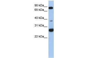 WB Suggested Anti-C1orf110 Antibody Titration: 0. (C1ORF110 anticorps  (N-Term))