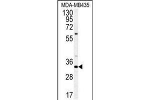 Western blot analysis of SGF29 Antibody in MDA-MB435 cell line lysates (35ug/lane) (SGF29 anticorps  (C-Term))