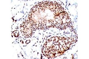 IHC staining of human tonsil with SUMO1 antibody (SM1/495). (SUMO1 anticorps)