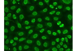 Immunofluorescence analysis of HeLa cells using FEN1 antibody. (FEN1 anticorps)