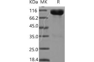 Western Blotting (WB) image for Activated Leukocyte Cell Adhesion Molecule (ALCAM) (Active) protein (Fc Tag) (ABIN7321186) (CD166 Protein (Fc Tag))