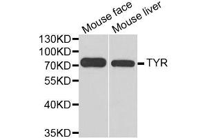 Western blot analysis of extracts of various cell lines, using TYR antibody. (TYR anticorps  (AA 20-340))